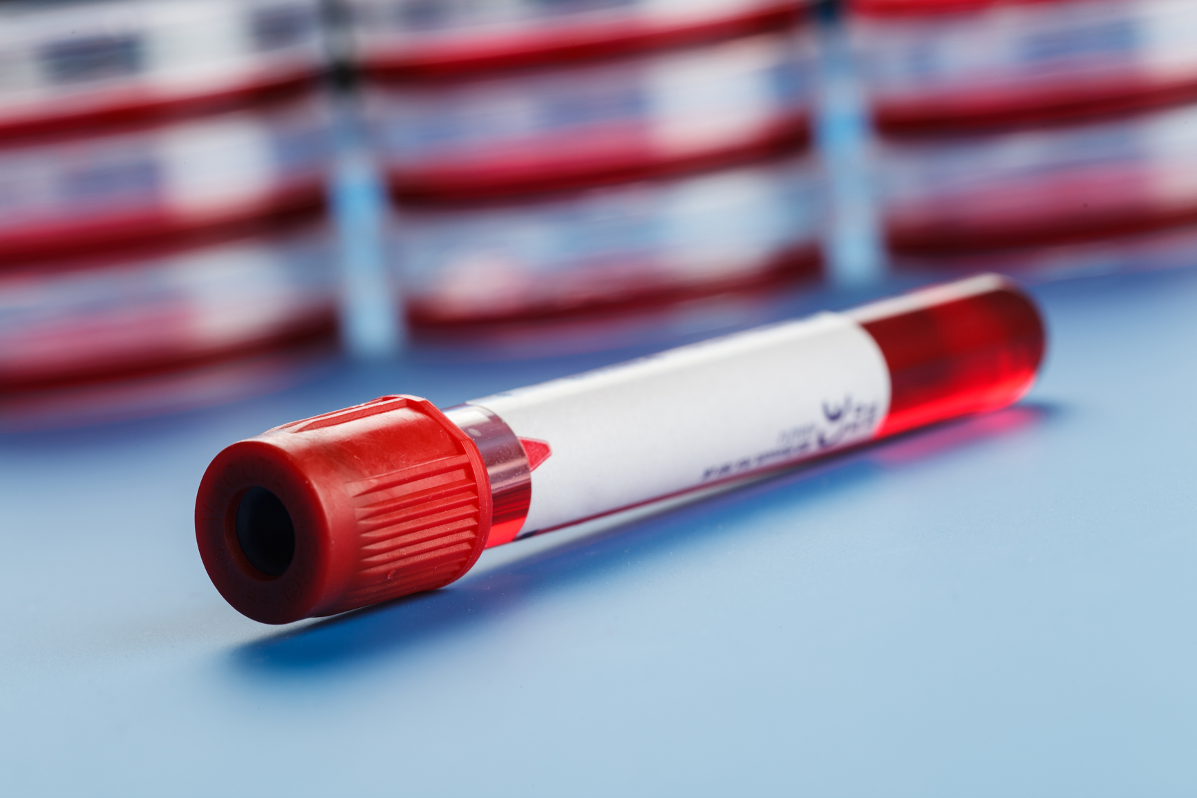 So what exactly is phlebotomy